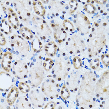 CCAR2 / KIAA1967 Antibody - Immunohistochemistry of paraffin-embedded rat kidney tissue.