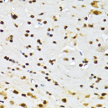 CCAR2 / KIAA1967 Antibody - Immunohistochemistry of paraffin-embedded mouse brain tissue.