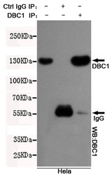 CCAR2 / KIAA1967 Antibody - Immunoprecipitation analysis of HeLa cell lysates using DBC1 mouse monoclonal antibody.