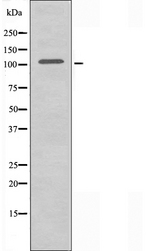 CCAR2 / KIAA1967 Antibody - Western blot analysis of extracts of Jurkat cells using KIAA1967 antibody.