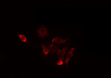CCAR2 / KIAA1967 Antibody - Staining HeLa cells by IF/ICC. The samples were fixed with PFA and permeabilized in 0.1% Triton X-100, then blocked in 10% serum for 45 min at 25°C. The primary antibody was diluted at 1:200 and incubated with the sample for 1 hour at 37°C. An Alexa Fluor 594 conjugated goat anti-rabbit IgG (H+L) Ab, diluted at 1/600, was used as the secondary antibody.