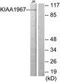 CCAR2 / KIAA1967 Antibody - Western blot analysis of extracts from Jurkat cells, using KIAA1967 antibody.