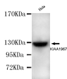 CCAR2 / KIAA1967 Antibody - KIAA1967(N-terminus) antibody at 1/1000 dilution HeLa cells 40 ug/Lane.