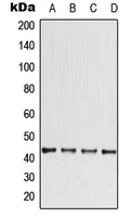 CCBE1 Antibody - Western blot analysis of CCBE1 expression in ACHN (A); HeLa (B); SP2/0 (C); PC12 (D) whole cell lysates.