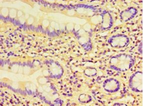 CCBL1 Antibody - Immunohistochemistry of paraffin-embedded human small intestine tissue using antibody at 1:100 dilution.  This image was taken for the unconjugated form of this product. Other forms have not been tested.