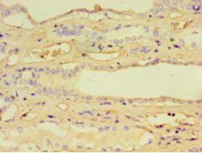 CCBL1 Antibody - Immunohistochemistry of paraffin-embedded human kidney tissue using antibody at 1:100 dilution.  This image was taken for the unconjugated form of this product. Other forms have not been tested.