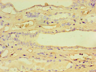 CCBL1 Antibody - Immunohistochemistry of paraffin-embedded human kidney tissue using KYAT1 Antibody at dilution of 1:100