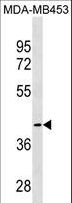 CCBL1 Antibody - CCBL1 Antibody western blot of MDA-MB453 cell line lysates (35 ug/lane). The CCBL1 antibody detected the CCBL1 protein (arrow).