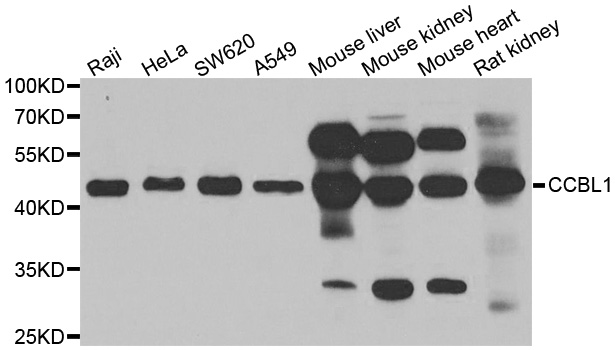 CCBL1 Antibody - Western blot analysis of extracts of various cell lines.