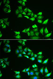 CCBL1 Antibody - Immunofluorescence analysis of HeLa cells.