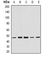 CCBL1 Antibody - Western blot analysis of CCBL1 expression in HeLa (A); A549 (B); mouse liver (C); mouse heart (D); rat kidney (E) whole cell lysates.