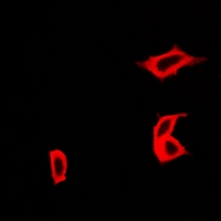 CCBL1 Antibody - Immunofluorescent analysis of CCBL1 staining in HeLa cells. Formalin-fixed cells were permeabilized with 0.1% Triton X-100 in TBS for 5-10 minutes and blocked with 3% BSA-PBS for 30 minutes at room temperature. Cells were probed with the primary antibody in 3% BSA-PBS and incubated overnight at 4 deg C in a humidified chamber. Cells were washed with PBST and incubated with a DyLight 594-conjugated secondary antibody (red) in PBS at room temperature in the dark.