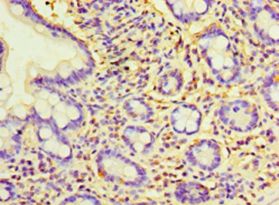 CCBL2 Antibody - Immunohistochemistry of paraffin-embedded human small intestine using antibody at 1:100 dilution.  This image was taken for the unconjugated form of this product. Other forms have not been tested.