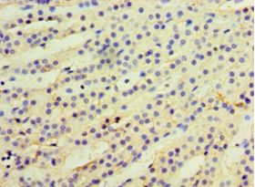 CCBL2 Antibody - Immunohistochemistry of paraffin-embedded human adrenal gland using antibody at 1:100 dilution.  This image was taken for the unconjugated form of this product. Other forms have not been tested.