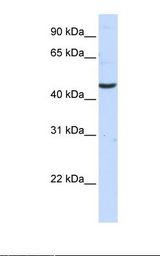 CCBL2 Antibody - Fetal brain lysate. Antibody concentration: 1.0 ug/ml. Gel concentration: 12%.  This image was taken for the unconjugated form of this product. Other forms have not been tested.