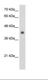 CCBL2 Antibody - Jurkat Cell Lysate.  This image was taken for the unconjugated form of this product. Other forms have not been tested.