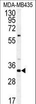 CCDC101 Antibody - Western blot of SGF29 Antibody in MDA-MB435 cell line lysates (35 ug/lane). SGF29 (arrow) was detected using the purified antibody.