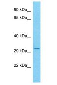 CCDC101 Antibody - CCDC101 antibody Western Blot of Jurkat. Antibody dilution: 1 ug/ml.  This image was taken for the unconjugated form of this product. Other forms have not been tested.