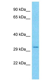 CCDC101 Antibody - CCDC101 antibody Western Blot of Jurkat. Antibody dilution: 1 ug/ml.  This image was taken for the unconjugated form of this product. Other forms have not been tested.