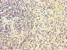 CCDC101 Antibody - Immunohistochemistry of paraffin-embedded human spleen tissue using SGF29 Antibody at dilution of 1:100