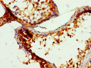 CCDC101 Antibody - Immunohistochemistry of paraffin-embedded human testis tissue using SGF29 Antibody at dilution of 1:100