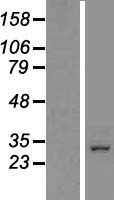CCDC101 Protein - Western validation with an anti-DDK antibody * L: Control HEK293 lysate R: Over-expression lysate