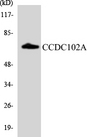 CCDC102A Antibody - Western blot analysis of the lysates from HepG2 cells using CCDC102A antibody.