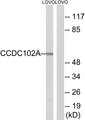CCDC102A Antibody - Western blot analysis of lysates from LOVO cells, using CCDC102A Antibody. The lane on the right is blocked with the synthesized peptide.