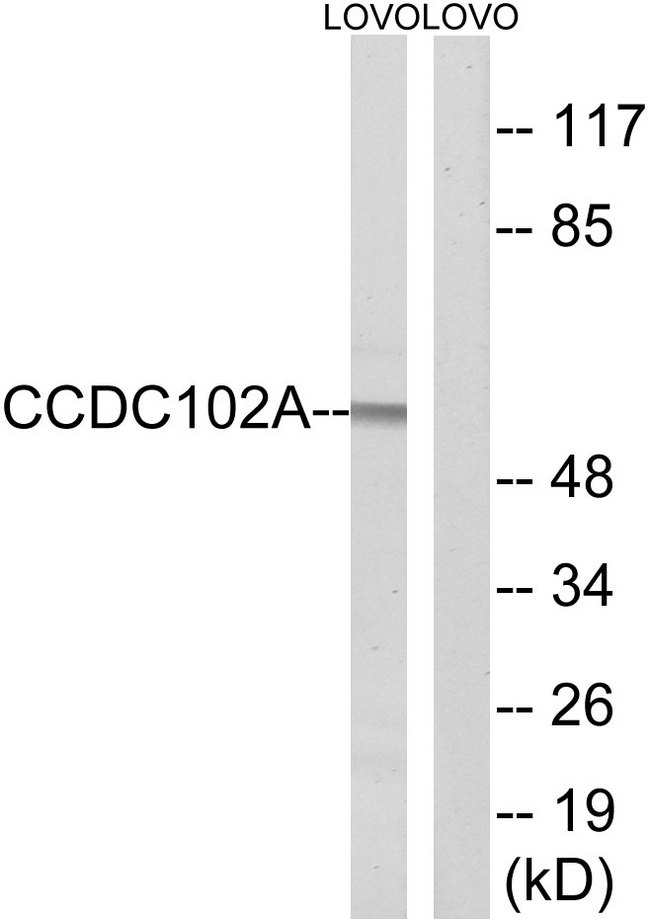 CCDC102A Antibody - Western blot analysis of lysates from LOVO cells, using CCDC102A Antibody. The lane on the right is blocked with the synthesized peptide.
