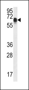 CCDC102A Antibody - CCDC102A Antibody western blot of mouse bladder tissue lysates (35 ug/lane). The CCDC102A antibody detected the CCDC102A protein (arrow).