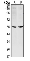 CCDC102A Antibody - Western blot analysis of CCDC102A expression in H1792 (A), SP20 (B) whole cell lysates.