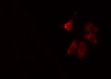 CCDC102A Antibody - Staining LOVO cells by IF/ICC. The samples were fixed with PFA and permeabilized in 0.1% Triton X-100, then blocked in 10% serum for 45 min at 25°C. The primary antibody was diluted at 1:200 and incubated with the sample for 1 hour at 37°C. An Alexa Fluor 594 conjugated goat anti-rabbit IgG (H+L) antibody, diluted at 1/600, was used as secondary antibody.