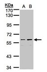 CCDC102B Antibody - Sample (30g whole cell lysate). A: Hep G2 , B: MOLT4 . 7.5% SDS PAGE. HsT1731 / CCDC102B antibody diluted at 1:1000