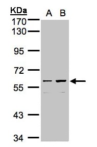 CCDC102B Antibody - Sample (30g whole cell lysate). A: Hep G2 , B: MOLT4 . 7.5% SDS PAGE. HsT1731 / CCDC102B antibody diluted at 1:1000