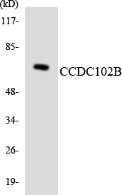 CCDC102B Antibody - Western blot analysis of the lysates from HUVECcells using CCDC102B antibody.