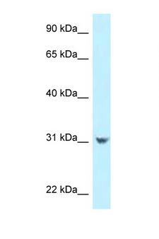 CCDC102B Antibody - CCDC102B antibody Western blot of HepG2 Cell lysate. Antibody concentration 1 ug/ml.  This image was taken for the unconjugated form of this product. Other forms have not been tested.