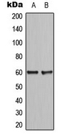 CCDC102B Antibody - Western blot analysis of CCDC102B expression in HepG2 (A); NIH3T3 (B) whole cell lysates.