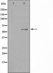 CCDC102B Antibody - Western blot analysis of extracts of HuvEc cells using CCDC102B antibody. The lane on the left is treated with the antigen-specific peptide.