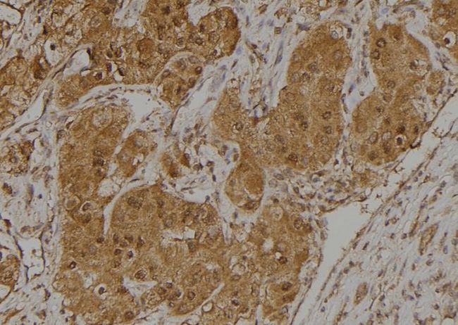 CCDC102B Antibody - 1:100 staining human kidney tissue by IHC-P. The sample was formaldehyde fixed and a heat mediated antigen retrieval step in citrate buffer was performed. The sample was then blocked and incubated with the antibody for 1.5 hours at 22°C. An HRP conjugated goat anti-rabbit antibody was used as the secondary.