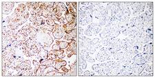 CCDC102B Antibody - Peptide - + Immunohistochemistry analysis of paraffin-embedded human placenta tissue, using CCDC102B antibody.