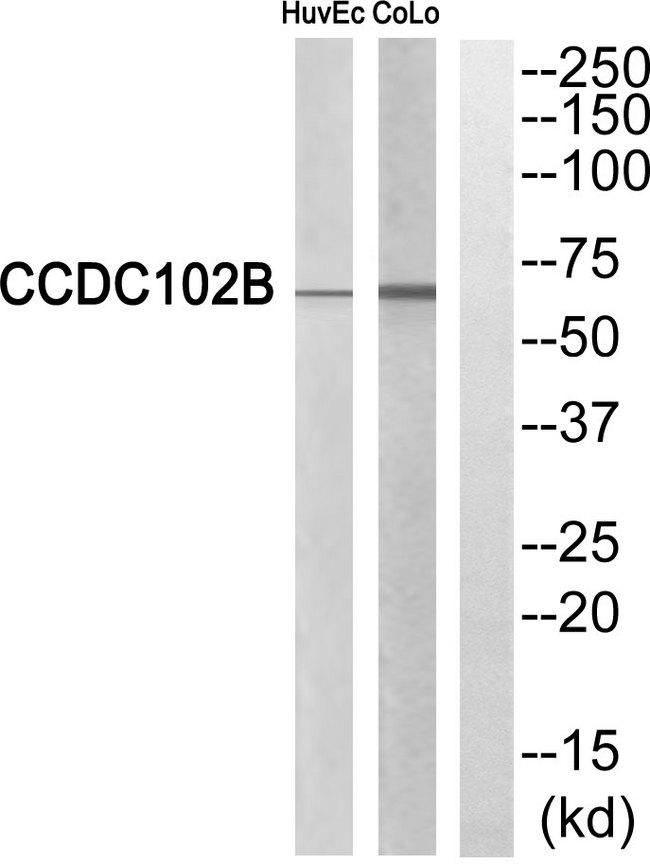 CCDC102B Antibody - Western blot analysis of extracts from HuvEc cells and COLO cells, using CCDC102B antibody.