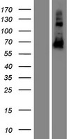 CCDC102B Protein - Western validation with an anti-DDK antibody * L: Control HEK293 lysate R: Over-expression lysate