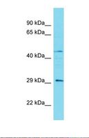 CCDC103 Antibody - Western blot of Human Fetal Kidney. CCDC103 antibody dilution 1.0 ug/ml.  This image was taken for the unconjugated form of this product. Other forms have not been tested.