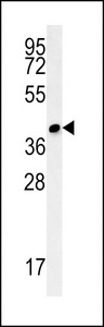 CCDC106 Antibody - CC106 Antibody western blot of mouse cerebellum tissue lysates (15 ug/lane). The CC106 antibody detected CC106 protein (arrow).