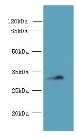 CCDC106 Antibody - Western blot. All lanes: CCDC106 antibody at 4 ug/ml+ Mouse brain tissue Goat polyclonal to rabbit at 1:10000 dilution. Predicted band size: 32 kDa. Observed band size: 32 kDa.
