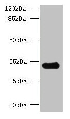 CCDC106 Antibody - Western blot All lanes: CCDC106 antibody at 4µg/ml + Mouse brain tissue Secondary Goat polyclonal to rabbit IgG at 1/10000 dilution Predicted band size: 33 kDa Observed band size: 33 kDa
