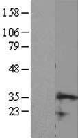 CCDC106 Protein - Western validation with an anti-DDK antibody * L: Control HEK293 lysate R: Over-expression lysate