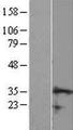 CCDC106 Protein - Western validation with an anti-DDK antibody * L: Control HEK293 lysate R: Over-expression lysate