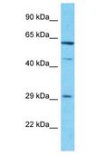 CCDC107 Antibody - CCDC107 antibody Western Blot of Jurkat. Antibody dilution: 1 ug/ml.  This image was taken for the unconjugated form of this product. Other forms have not been tested.