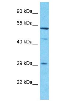 CCDC107 Antibody - CCDC107 antibody Western Blot of Jurkat. Antibody dilution: 1 ug/ml.  This image was taken for the unconjugated form of this product. Other forms have not been tested.